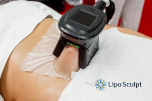 Cryolipolysis Bellshill can give you the best summer body - contact us today!