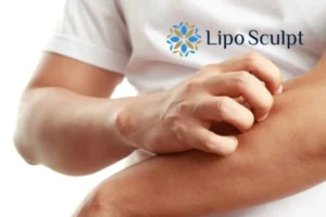 prevent your actinic keratoses Bellshill getting worse - call our team today!