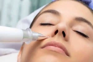 Actinic keratoses Bellshill solutions - book in today!