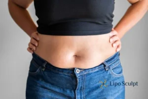 Bidding Farewell to Muffin Tops with Aqualyx Fat Injections 2 Do you wish you could reduce your muffin top Bellshill With Aqualy fat dissolving injections you can!