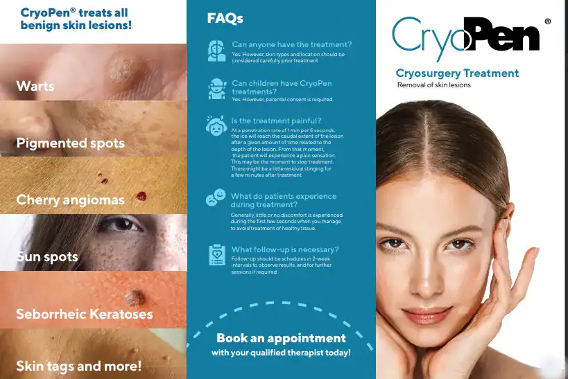 Benefits of Cryopen for seborrheic keratosis Removal Treatment Bellshill